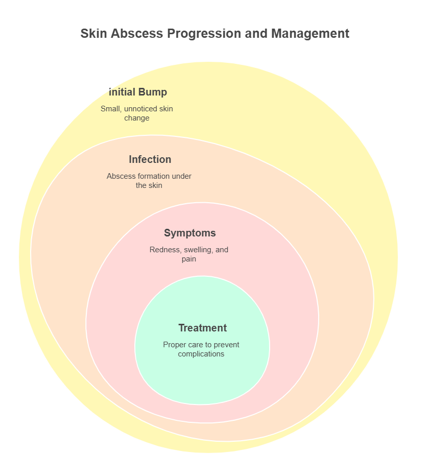 Skin Abscess Progression and Management