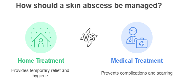 How should a skin abscess be managed?