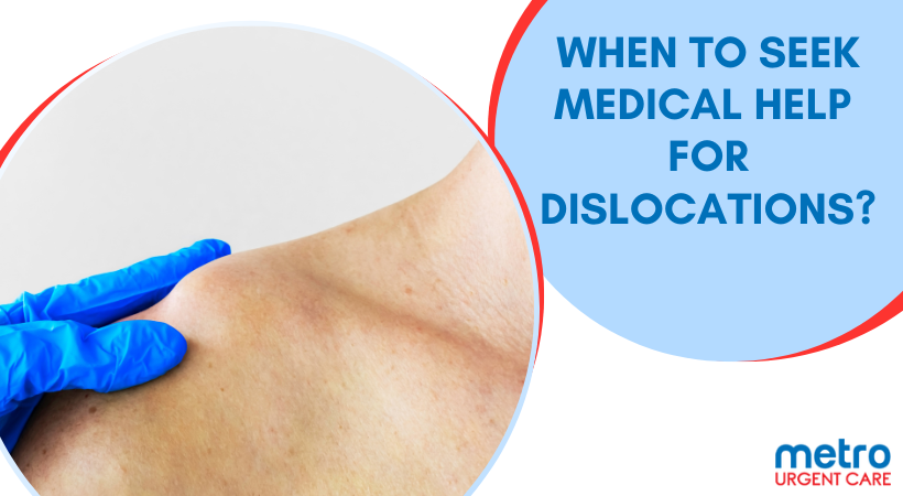 Medical Help for Dislocation