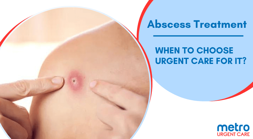 Abscess Treatment: When to Choose Urgent Care for It?
